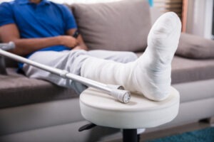 A man with a broken leg needs a San Jose personal injury lawyer.